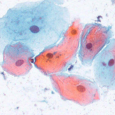 Cytology Slide Sample: Buccal Cells