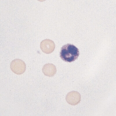 Cells on Microscope Slide (Hematology)