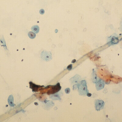 Cells on Microscope Slide (Urine)