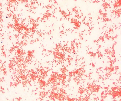 Gram Slide Sample