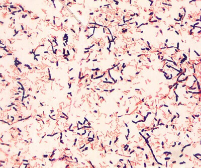 Gram Slide Sample