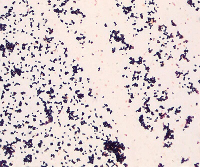 Gram Slide Sample