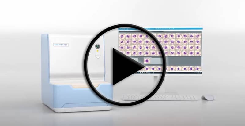 Video: How the DC-1 Works