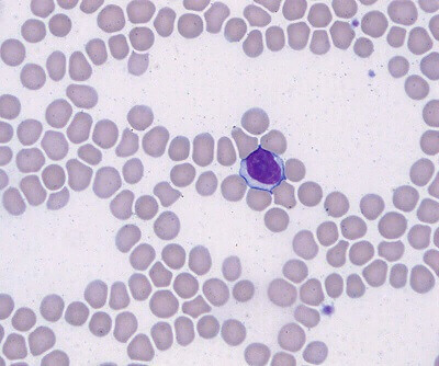 Hematology Pro Blood Smear Slide Sample: Wright Giemsa - 1