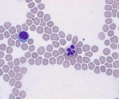 Hematology Pro Blood Smear: Wright Giemsa - 7
