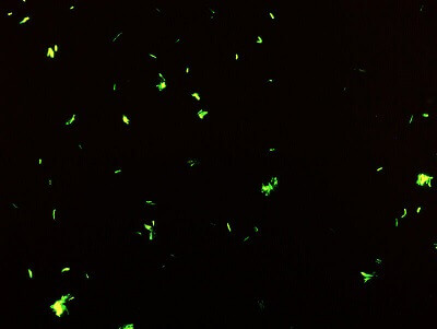 TB Slide Sample: Fluorescent Stain 1