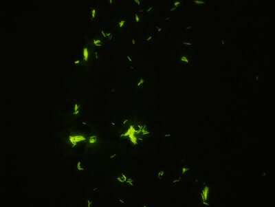 TB Slide Sample: Fluorescent Stain 2