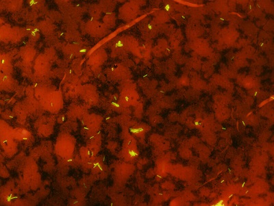 TB Slide Sample: Carbol Fuchsin Stain