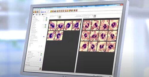 Peripheral Blood Application CellaVision&reg;